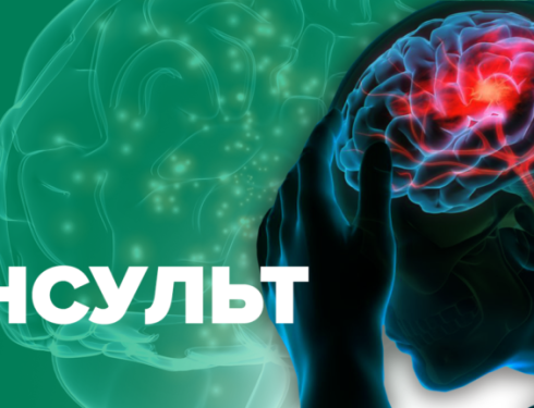 Порядок надання домедичної допомоги постраждалим при підозрі на гострий мозковий інсульт