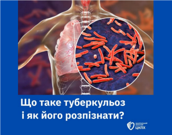 Туберкульоз (ТБ)